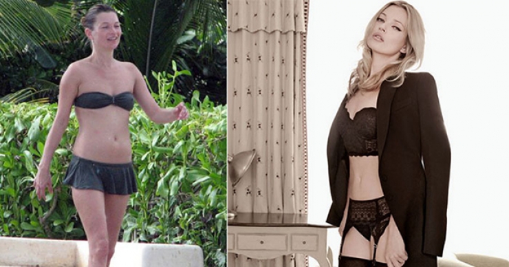 Illustration de l'article : 17 stars nous prouvent que personne n'est parfait ! Adieu Photoshop...