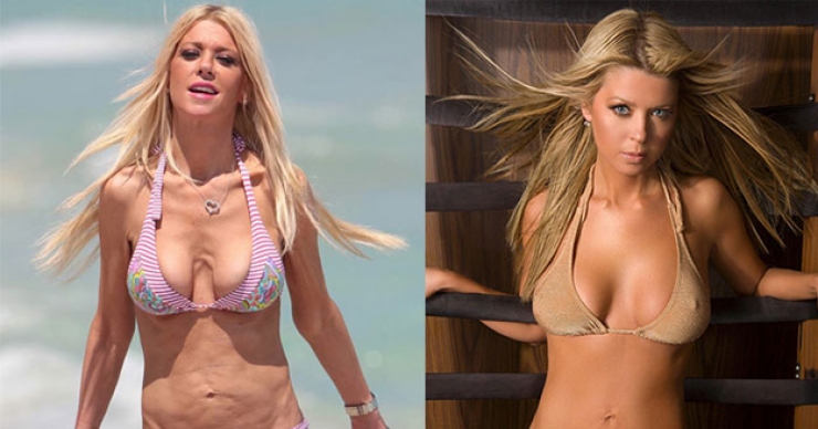 Illustration de l'article : 17 stars nous prouvent que personne n'est parfait ! Adieu Photoshop...
