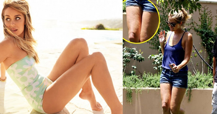 Illustration de l'article : 17 stars nous prouvent que personne n'est parfait ! Adieu Photoshop...