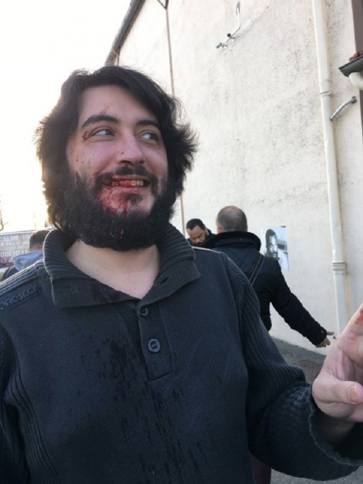 Illustration de l'article : Daniel Conversano se fait frapper par Alain Soral à plusieurs reprises...