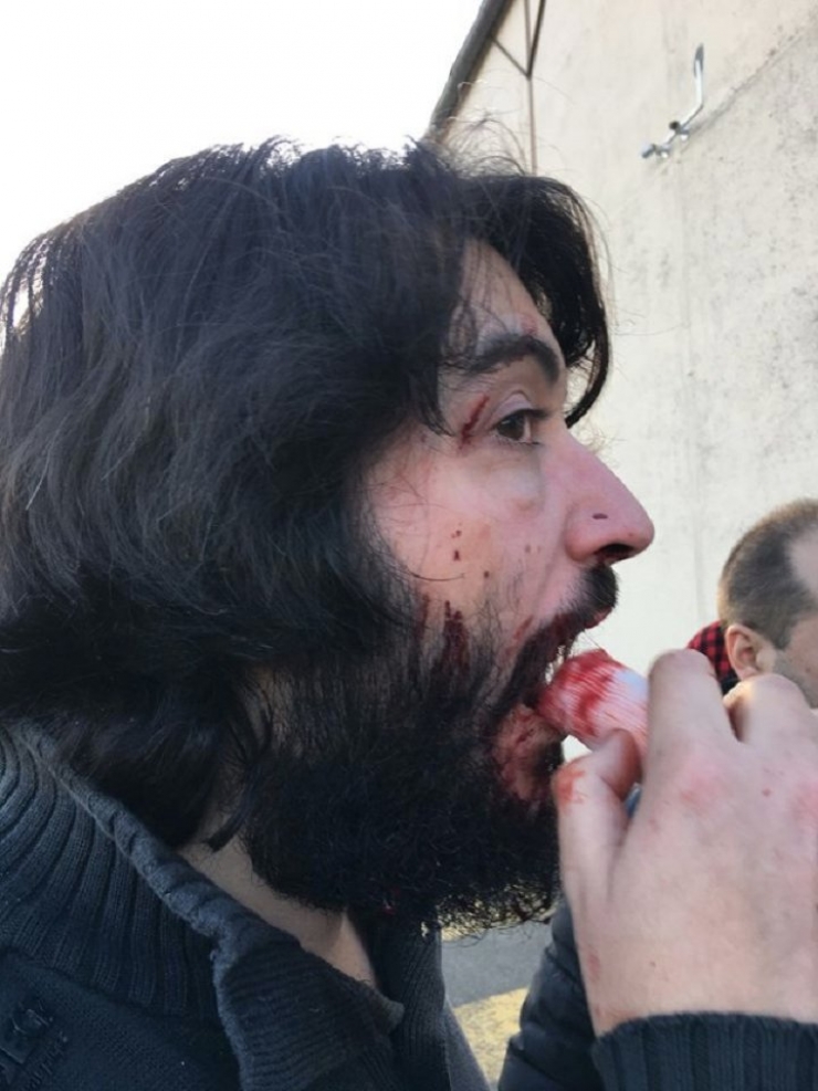 Illustration de l'article : Daniel Conversano se fait frapper par Alain Soral à plusieurs reprises...