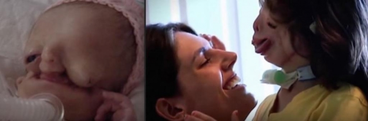 Illustration de l'article : Ce bébé a été abandonné dès la naissance, mais regardez ce qu'elle est devenue 6 ans plus tard !