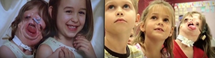 Illustration de l'article : Ce bébé a été abandonné dès la naissance, mais regardez ce qu'elle est devenue 6 ans plus tard !