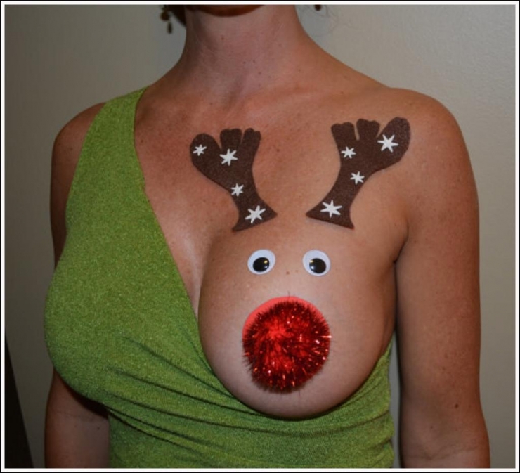 Illustration de l'article : Les femmes transforment leur poitrine pour Noël. Cette nouvelle mode affole le net à 3 jours du réveillon...