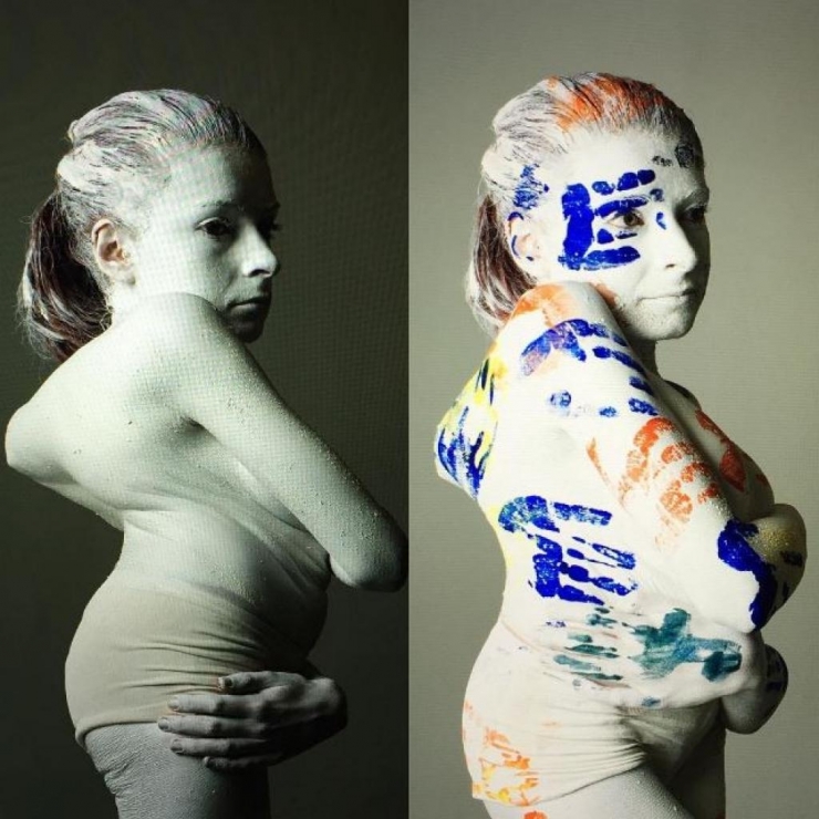 Illustration de l'article : Les médecins refusent de l'opérer à 9 ans, aujourd'hui, j'ai la chair de poule devant les photos de son corps.