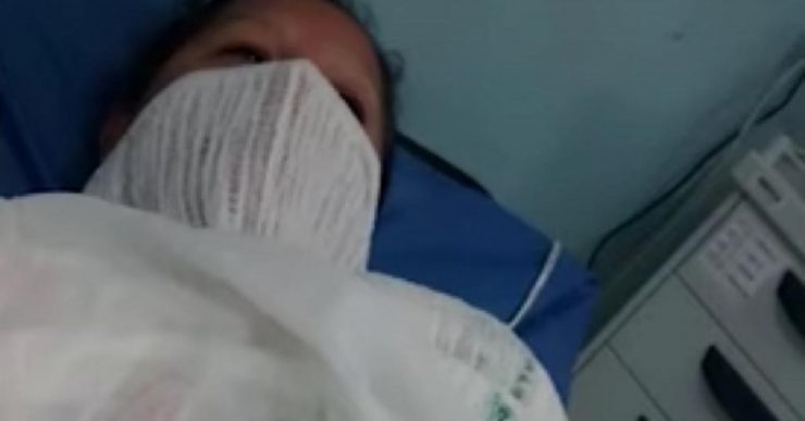 Illustration de l'article : Après avoir vécu ce brûlant cauchemar, c'est la première à recevoir ce traitement dans le monde!