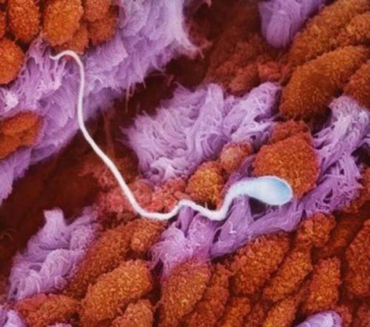 Illustration de l'article : La naissance d'un bébé étape par étape, illustrée par 23 photos magnifiques...