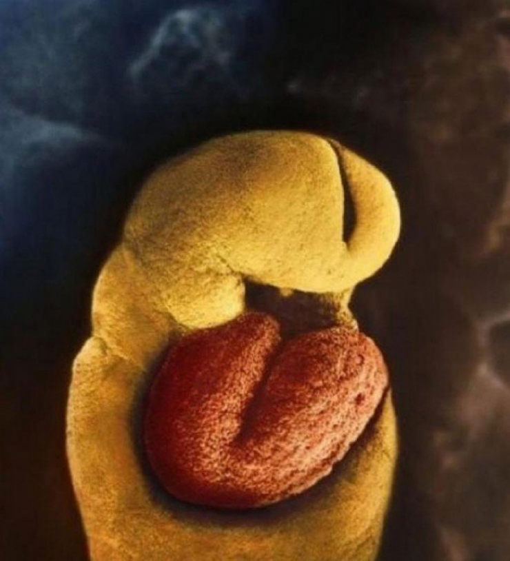 Illustration de l'article : La naissance d'un bébé étape par étape, illustrée par 23 photos magnifiques...