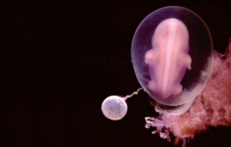 Illustration de l'article : La naissance d'un bébé étape par étape, illustrée par 23 photos magnifiques...