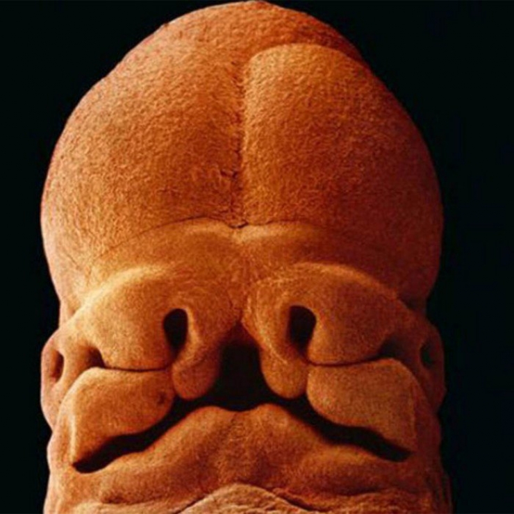 Illustration de l'article : La naissance d'un bébé étape par étape, illustrée par 23 photos magnifiques...
