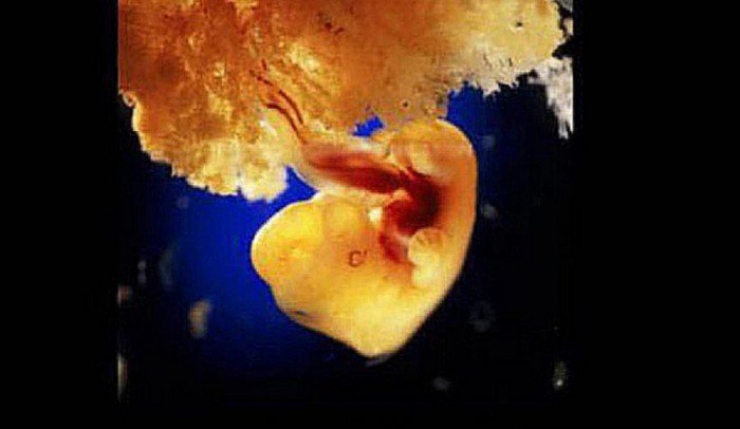 Illustration de l'article : La naissance d'un bébé étape par étape, illustrée par 23 photos magnifiques...