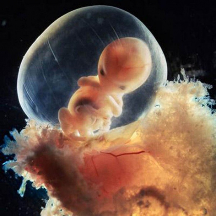 Illustration de l'article : La naissance d'un bébé étape par étape, illustrée par 23 photos magnifiques...