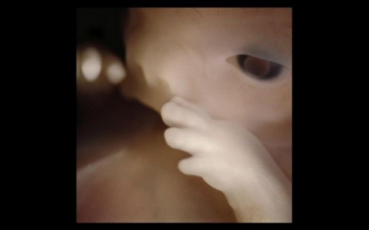 Illustration de l'article : La naissance d'un bébé étape par étape, illustrée par 23 photos magnifiques...