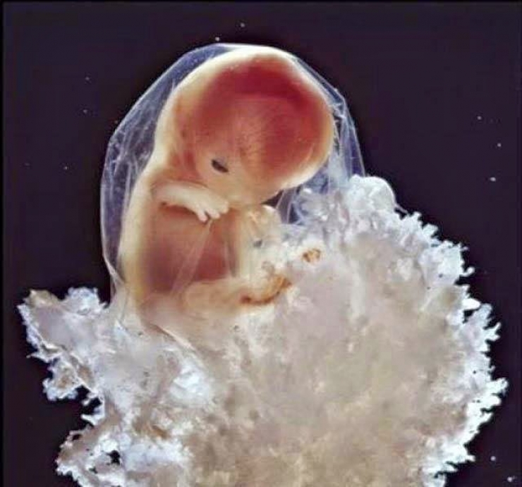 Illustration de l'article : La naissance d'un bébé étape par étape, illustrée par 23 photos magnifiques...