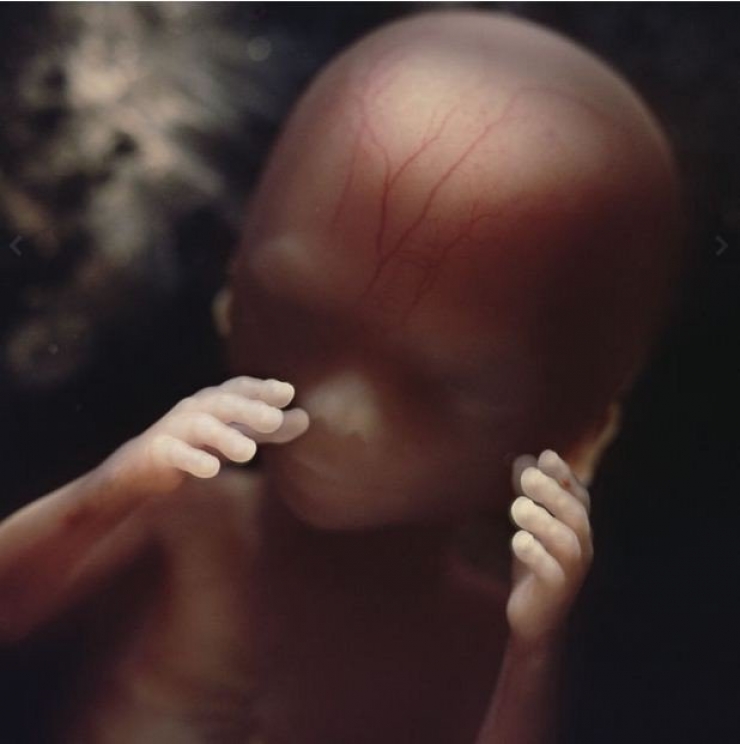 Illustration de l'article : La naissance d'un bébé étape par étape, illustrée par 23 photos magnifiques...