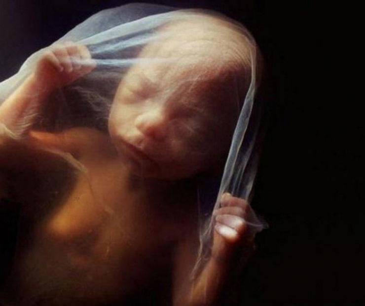 Illustration de l'article : La naissance d'un bébé étape par étape, illustrée par 23 photos magnifiques...