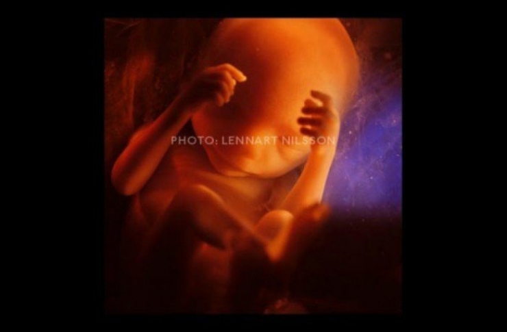 Illustration de l'article : La naissance d'un bébé étape par étape, illustrée par 23 photos magnifiques...