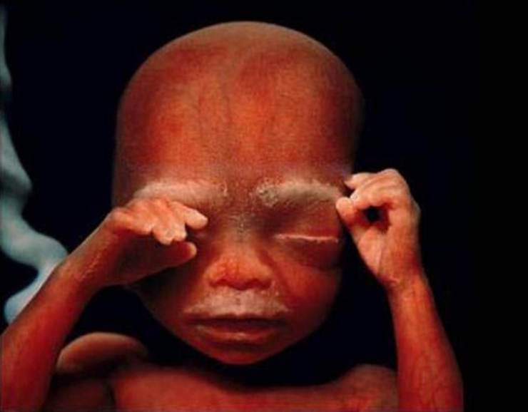 Illustration de l'article : La naissance d'un bébé étape par étape, illustrée par 23 photos magnifiques...