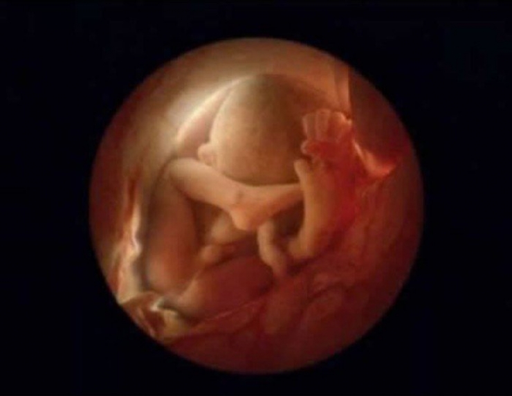 Illustration de l'article : La naissance d'un bébé étape par étape, illustrée par 23 photos magnifiques...