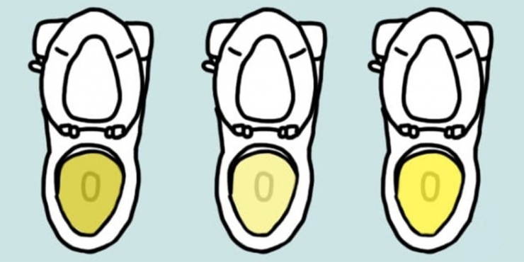 Illustration de l'article : La couleur de votre urine en dit long sur votre santé… Voici ce qu’il faut savoir: