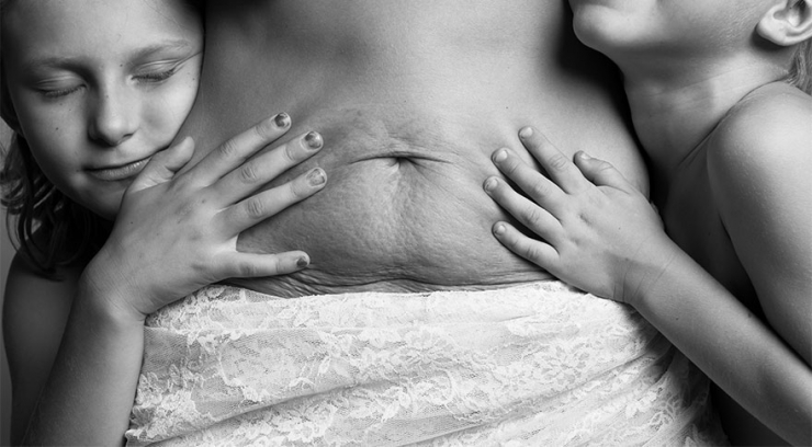 Illustration de l'article : Des images qui rendent hommage au vrai corps d’une maman après sa grossesse… Un projet de Jade Beall !
