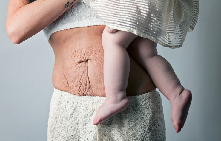 Illustration de l'article : Des images qui rendent hommage au vrai corps d’une maman après sa grossesse… Un projet de Jade Beall !
