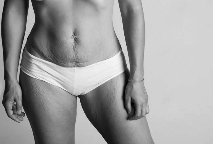 Illustration de l'article : Des images qui rendent hommage au vrai corps d’une maman après sa grossesse… Un projet de Jade Beall !