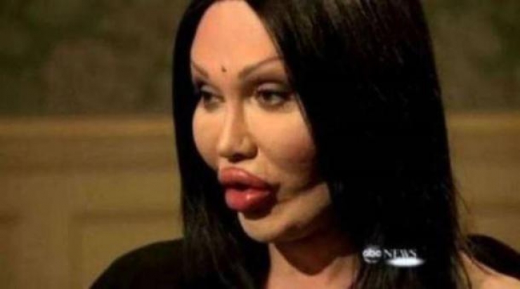 Illustration de l'article : La chirurgie esthétique n'est pas la solution à tout, la preuve avec ces 27 photos !