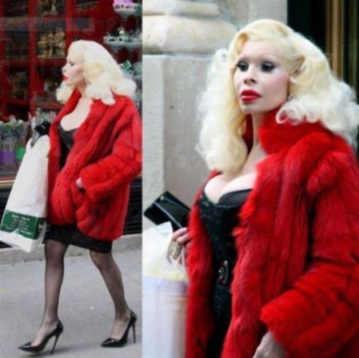 Illustration de l'article : La chirurgie esthétique n'est pas la solution à tout, la preuve avec ces 27 photos !