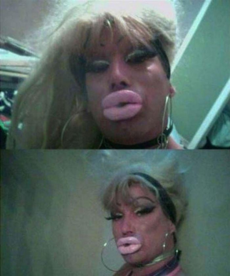 Illustration de l'article : La chirurgie esthétique n'est pas la solution à tout, la preuve avec ces 27 photos !