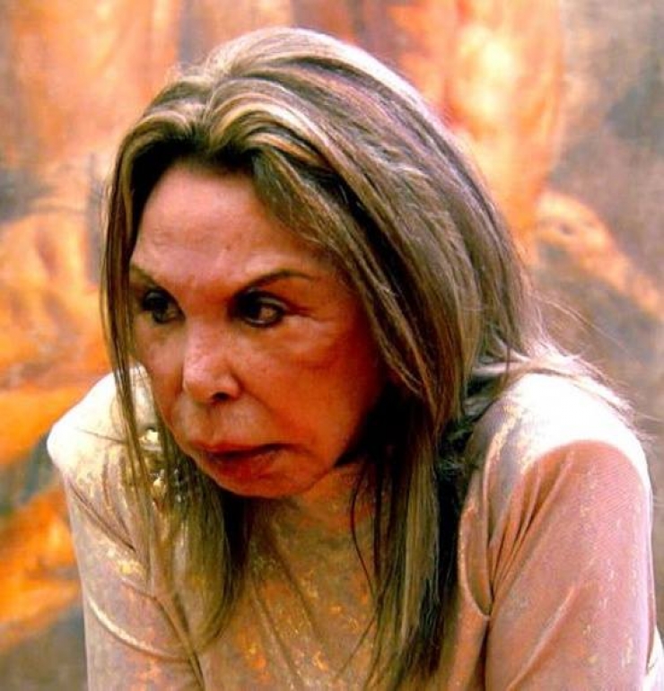 Illustration de l'article : La chirurgie esthétique n'est pas la solution à tout, la preuve avec ces 27 photos !