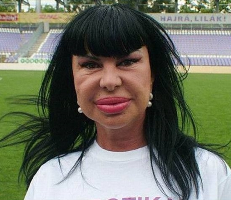 Illustration de l'article : La chirurgie esthétique n'est pas la solution à tout, la preuve avec ces 27 photos !