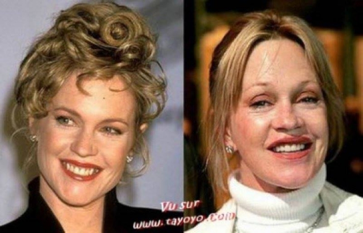 Illustration de l'article : La chirurgie esthétique n'est pas la solution à tout, la preuve avec ces 27 photos !