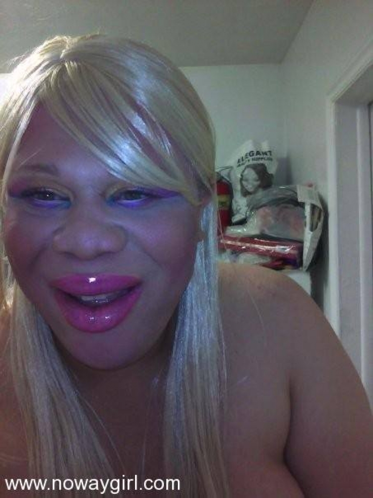 Illustration de l'article : La chirurgie esthétique n'est pas la solution à tout, la preuve avec ces 27 photos !