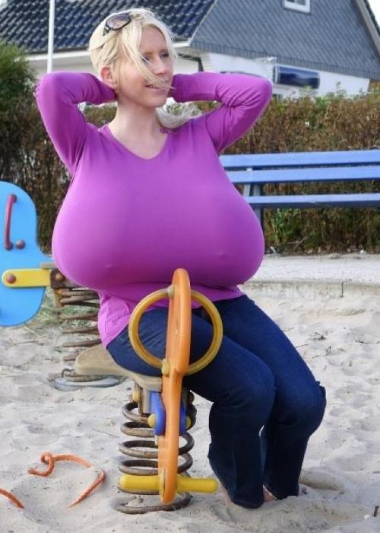 Illustration de l'article : La chirurgie esthétique n'est pas la solution à tout, la preuve avec ces 27 photos !