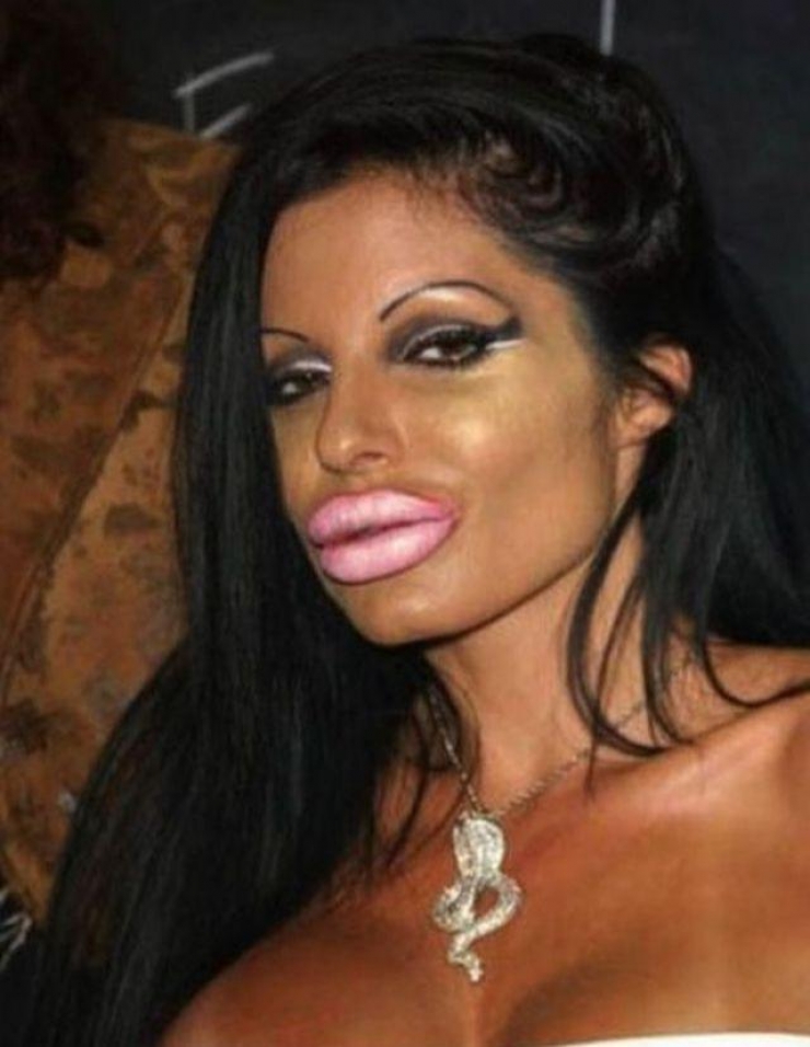 Illustration de l'article : La chirurgie esthétique n'est pas la solution à tout, la preuve avec ces 27 photos !