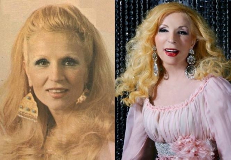 Illustration de l'article : La chirurgie esthétique n'est pas la solution à tout, la preuve avec ces 27 photos !