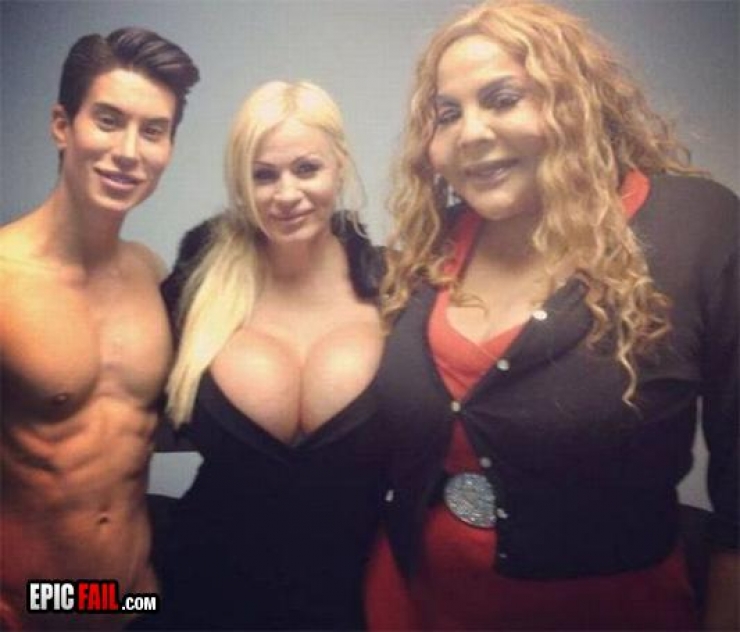 Illustration de l'article : La chirurgie esthétique n'est pas la solution à tout, la preuve avec ces 27 photos !