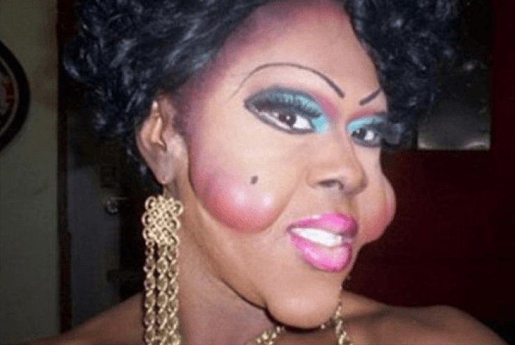 Illustration de l'article : La chirurgie esthétique n'est pas la solution à tout, la preuve avec ces 27 photos !