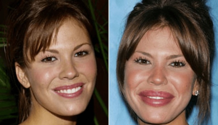 Illustration de l'article : La chirurgie esthétique n'est pas la solution à tout, la preuve avec ces 27 photos !