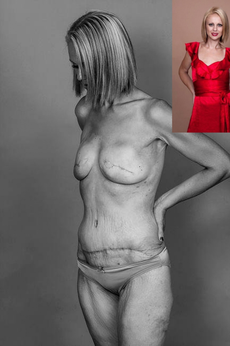 Illustration de l'article : Elle ne s'imaginait pas perdre 103 amis juste en postant ces photos sur Facebook...
