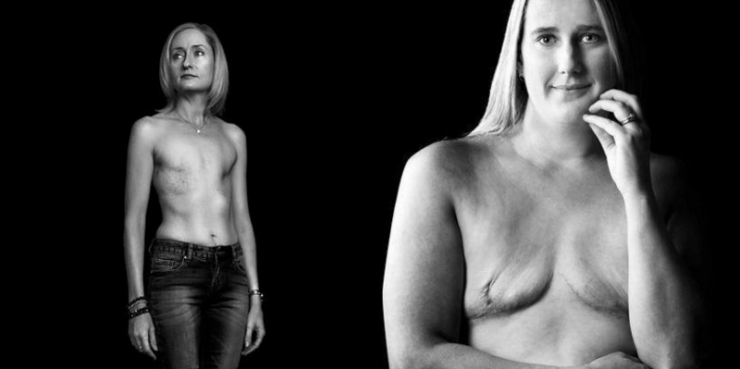 Illustration de l'article : Elle ne s'imaginait pas perdre 103 amis juste en postant ces photos sur Facebook...