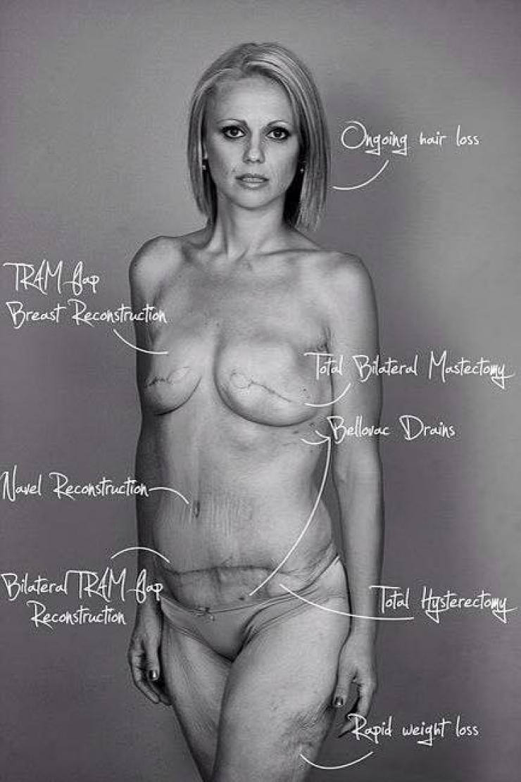 Illustration de l'article : Elle ne s'imaginait pas perdre 103 amis juste en postant ces photos sur Facebook...