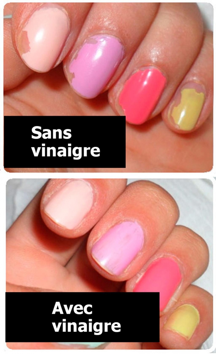 Illustration de l'article : 14 astuces pour avoir des ongles jolis et en pleine santé en toute simplicité