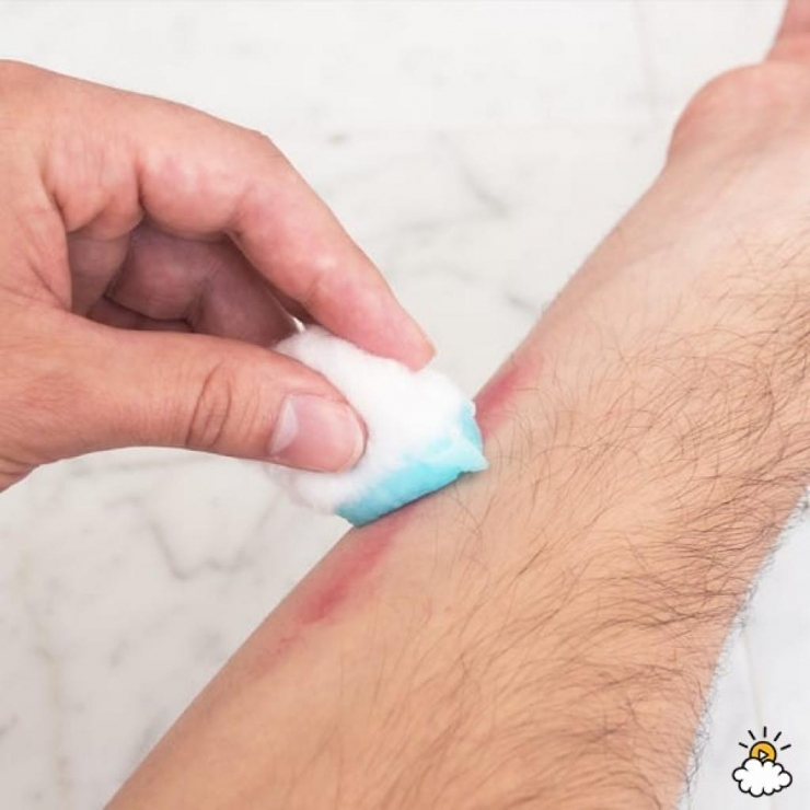 Illustration de l'article : Elle met du Listerine sur du coton et se frotte les aisselles avec... Une astuce brillante !