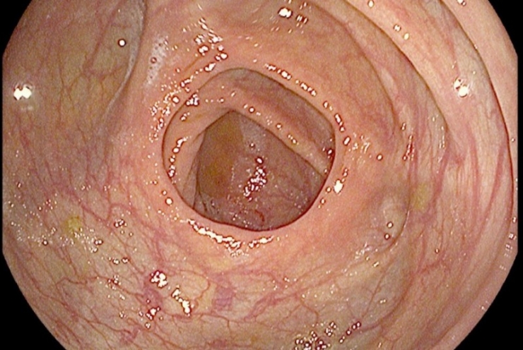 Illustration de l'article : Pour ces 7 bonnes raisons, ne vous retenez plus jamais de p&eacute;ter...