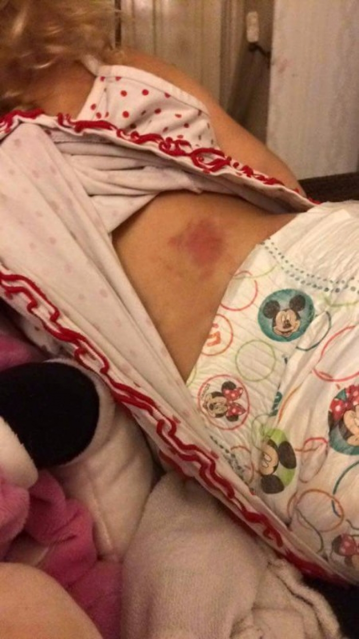 Illustration de l'article : Cette petite de 5 ans regarde sa soeur se faire maltraiter sans pouvoir réagir. Il faut attendre le retour de la maman pour que ce carnage éclate au grand jour !