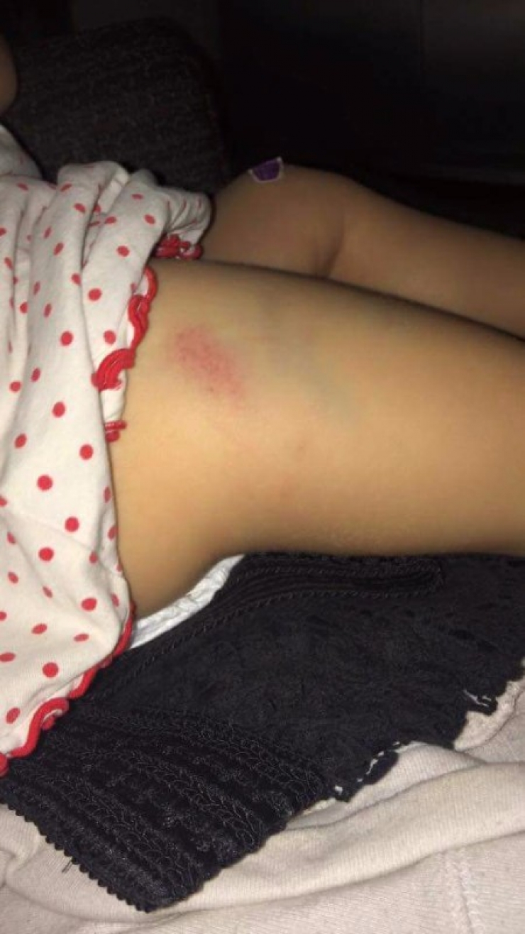 Illustration de l'article : Cette petite de 5 ans regarde sa soeur se faire maltraiter sans pouvoir réagir. Il faut attendre le retour de la maman pour que ce carnage éclate au grand jour !