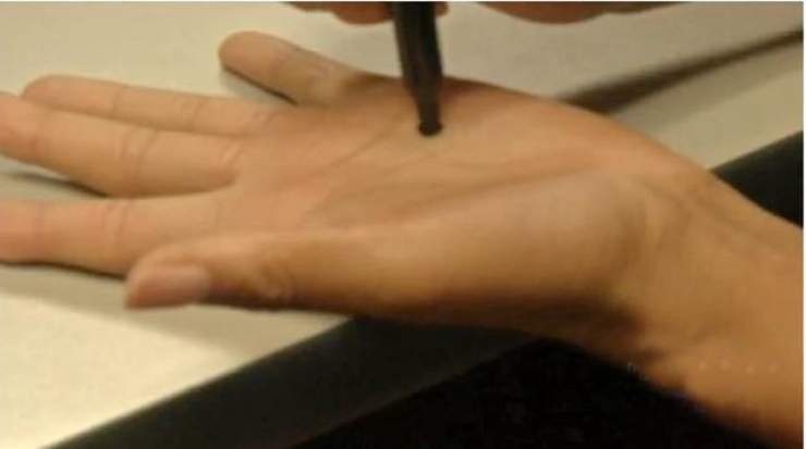 Illustration de l'article : Si une femme vous montre un point noir sur sa main, ne restez pas indiff&eacute;rent ! Ceci peut sauver des vies !