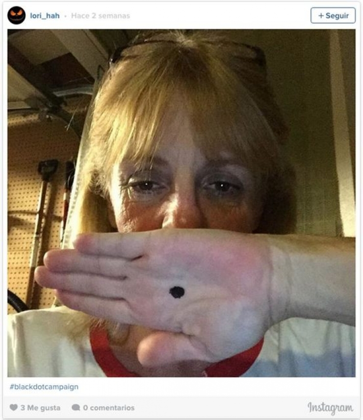 Illustration de l'article : Si une femme vous montre un point noir sur sa main, ne restez pas indiff&eacute;rent ! Ceci peut sauver des vies !